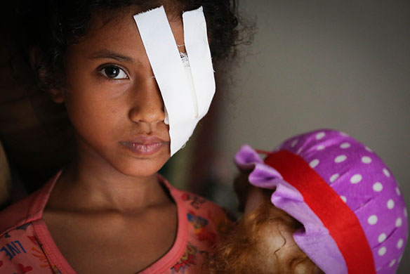 Yemen crisis