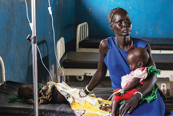  Why do malnourished children have big bellies?  